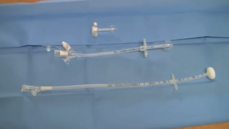 Stomach Feeding Tube